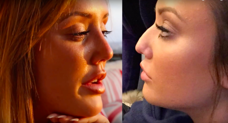 Inside Charlotte Crosby’s crazy surgeries - from ‘uniboob’ correction to extreme nose jobs