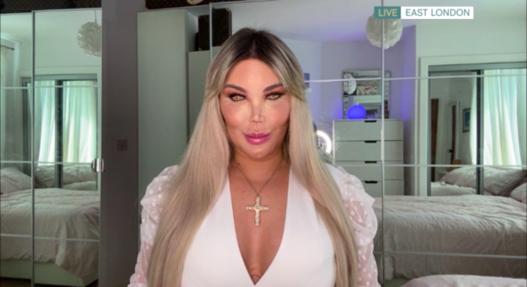 Who is Jessica Alves? ‘Human Ken Doll’ talks life after surgery on This Morning