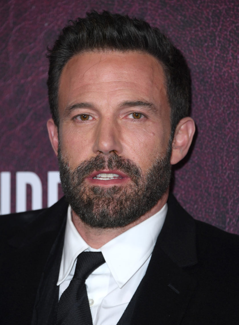 Rewind a few years and Ben Affleck's teeth looked shockingly different