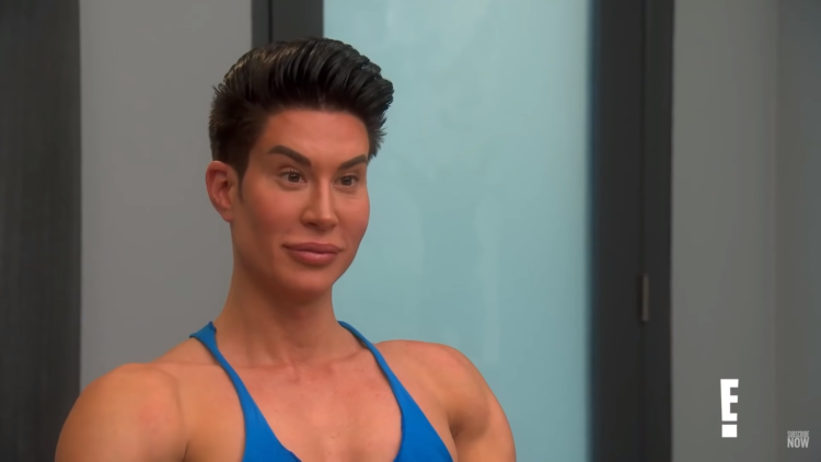 Botched patient had 1000 procedures in obsession to turn into 'human Ken doll'